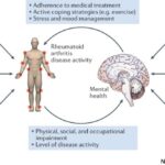 تاثیر استرس بر روی بیماریهای روماتیسمی